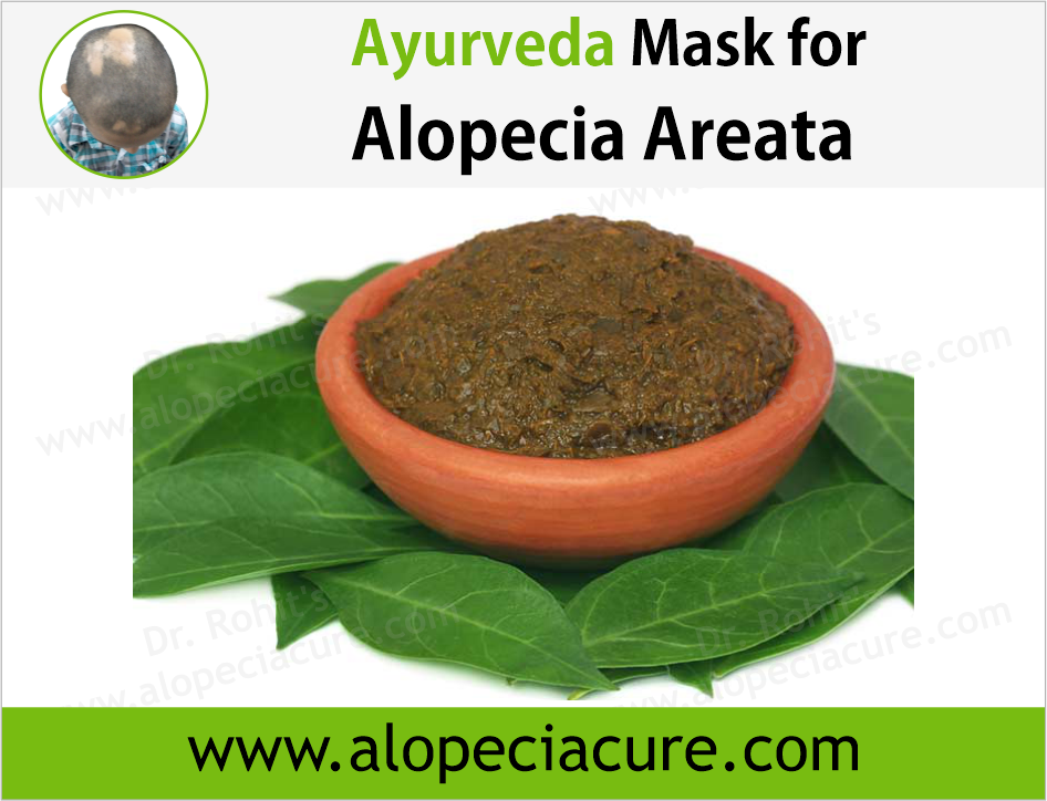 100% Natural Treatments for Alopecia Areata